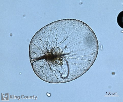 Photo of Noctiluca scintillans